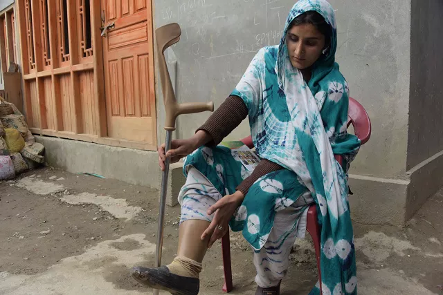 salima bibi 24 a victim of a landmine wearing an artificial limb before giving an awareness campaign for landmines talk to local residents at a village in neelum valley photo afp salima bibi 24 a victim of a landmine wearing an artificial limb before giving an awareness campaign for landmines talk to local residents at a village in neelum valley photo afp