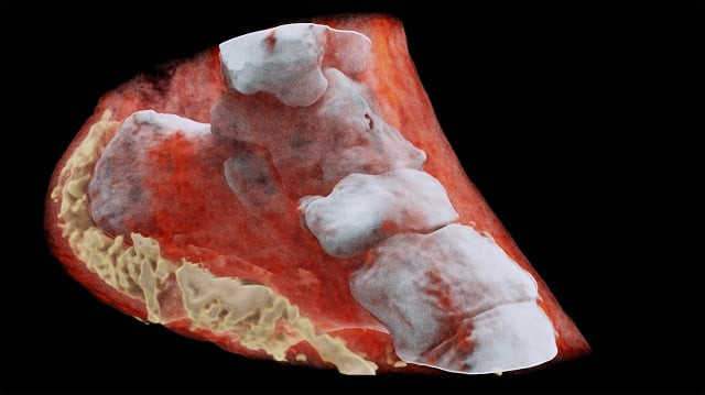this handout picture released on july 12 2018 by mars bioimaging ltd shows a 3d image of left view of an ankle with bones in white and soft tissue in red photo afp this handout picture released on july 12 2018 by mars bioimaging ltd shows a 3d image of left view of an ankle with bones in white and soft tissue in red photo afp