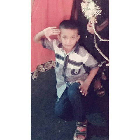 muhammad umar who lost his arms after a high tension wire fell on him photo courtesy victim 039 s family muhammad umar who lost his arms after a high tension wire fell on him photo courtesy victim 039 s family