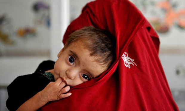 last two years statistics show that some 75 children under five were malnourished jhal magsi dho says photo afp