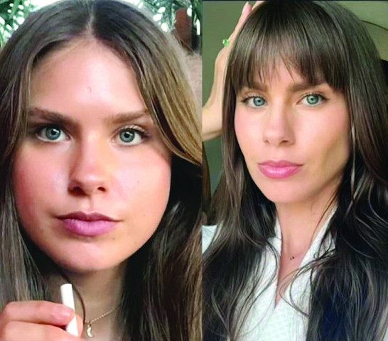 is cortisol face really a thing is cortisol face really a thing