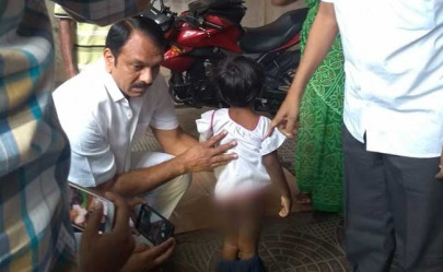 four year old indian girl burnt beaten and branded by daddy