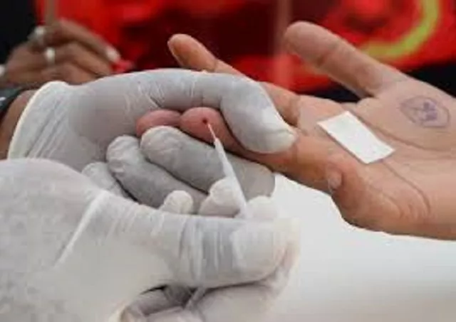 the un says nearly 37 million people worldwide are infected with hiv which if left untreated can lead to aids photo afp the un says nearly 37 million people worldwide are infected with hiv which if left untreated can lead to aids photo afp