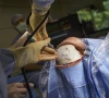 wooden fragment removed from patient s brain