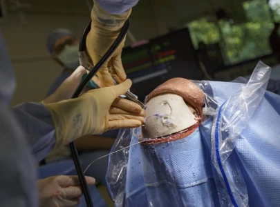 wooden fragment removed from patient s brain