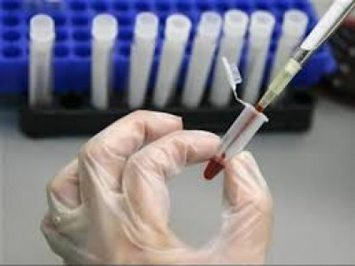 investigating epidemics k p to create network of diagnostic labs investigating epidemics k p to create network of diagnostic labs