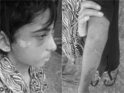 employers booked for torturing child maid in rawalpindi employers booked for torturing child maid in rawalpindi