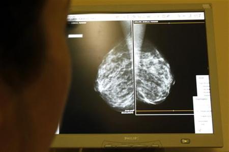 a high recurrence score above 25 means chemo is necessary to ward off a recurrence while a low score below 10 means it is not photo reuters file