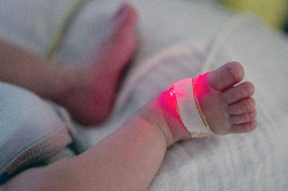 france launches nationwide probe into baby arm deformations
