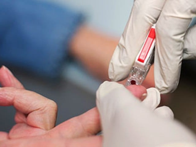 a lot of patients were suffering from serious health consequences due to spread of influenza virus photo file a lot of patients were suffering from serious health consequences due to spread of influenza virus photo file