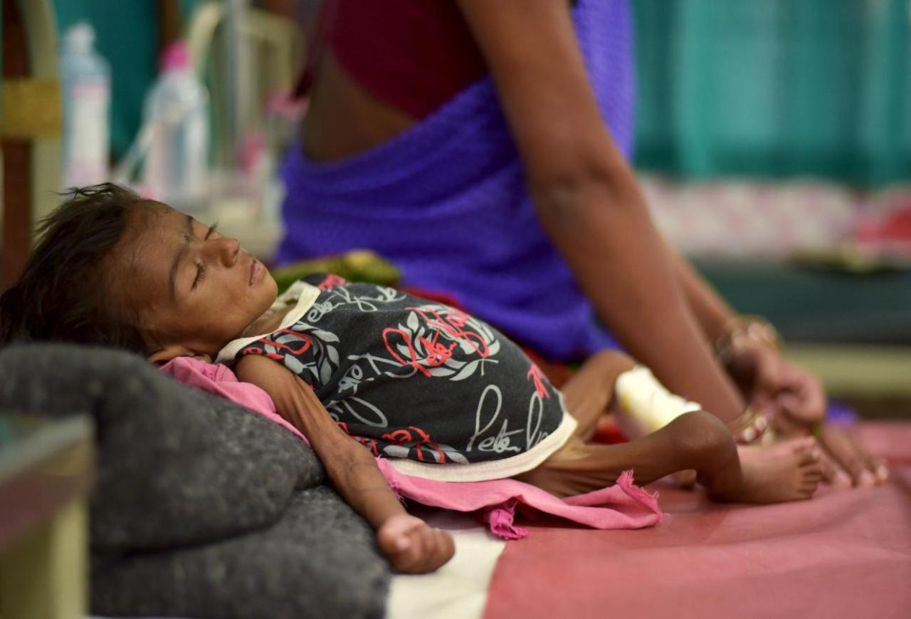 representational image of a malnutrition ed child photo reuters