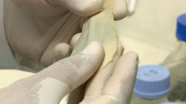 dr rauf ahmed urges govt to take measures to enable production of the skin at mass level photo courtesy bbc dr rauf ahmed urges govt to take measures to enable production of the skin at mass level photo courtesy bbc