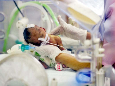 world prematurity day kangaroo mother care initiative to be launched at pims world prematurity day kangaroo mother care initiative to be launched at pims