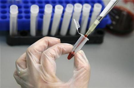 a laboratory technician examines blood samples for hiv aids photo reuters