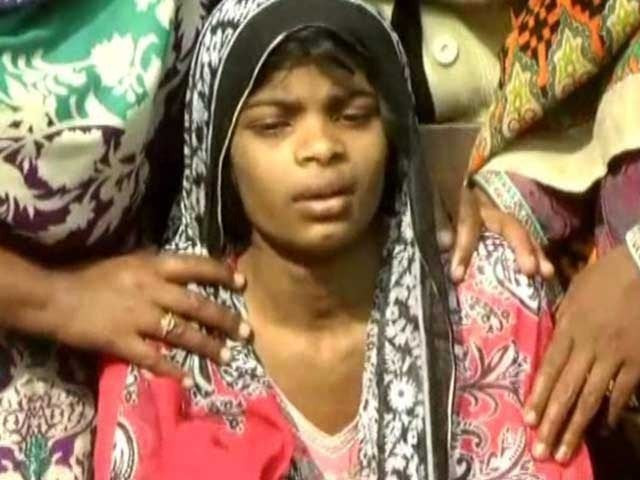 tanzeela 14 claims she was kept hungry for days boiling hot water thrown on her photo express tanzeela 14 claims she was kept hungry for days boiling hot water thrown on her photo express