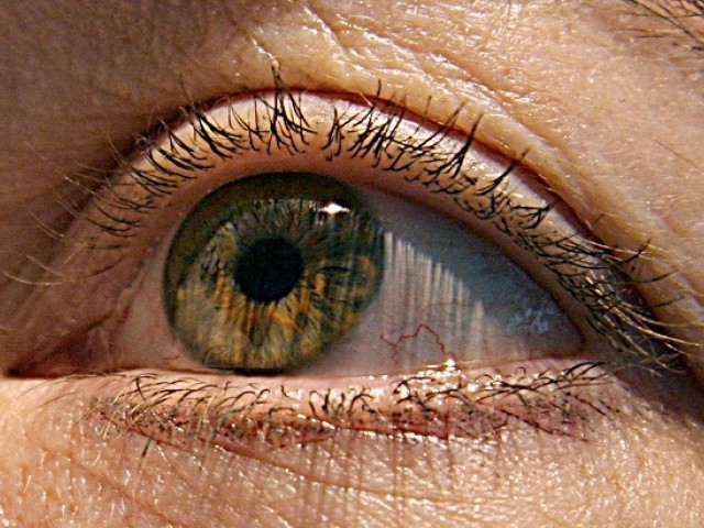 lrh operates on 60 with eye diseases in k p