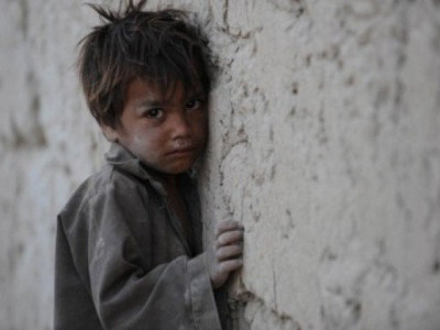children suffer malnutrition in sanghar