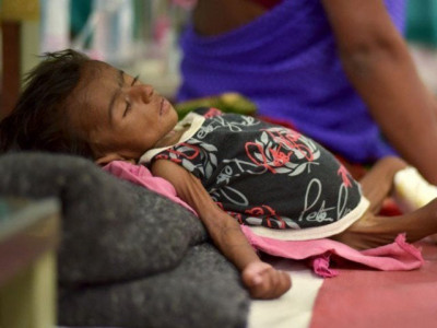 environmental enteropathy and stunting children environmental enteropathy and stunting children