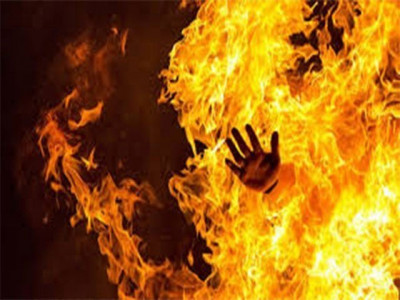 man set on fire by friends over petty dispute man set on fire by friends over petty dispute