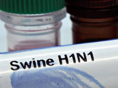 multan woman tests positive for swine flu multan woman tests positive for swine flu