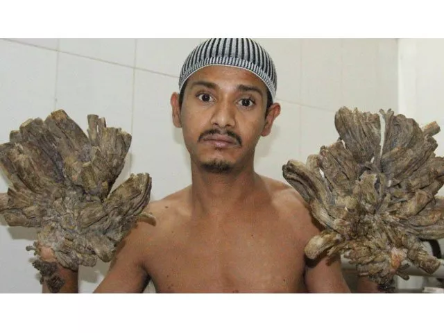 abul bajandar abul bajandar