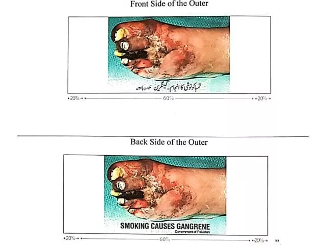 all local and imported packs to carry picture of gangrene disease caused by smoking from june 1 photo health ministry all local and imported packs to carry picture of gangrene disease caused by smoking from june 1 photo health ministry