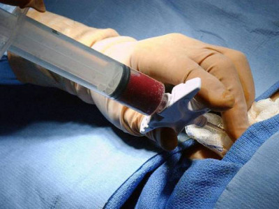 contempt plea court grants a week s time to release funds for bone marrow transplant contempt plea court grants a week s time to release funds for bone marrow transplant