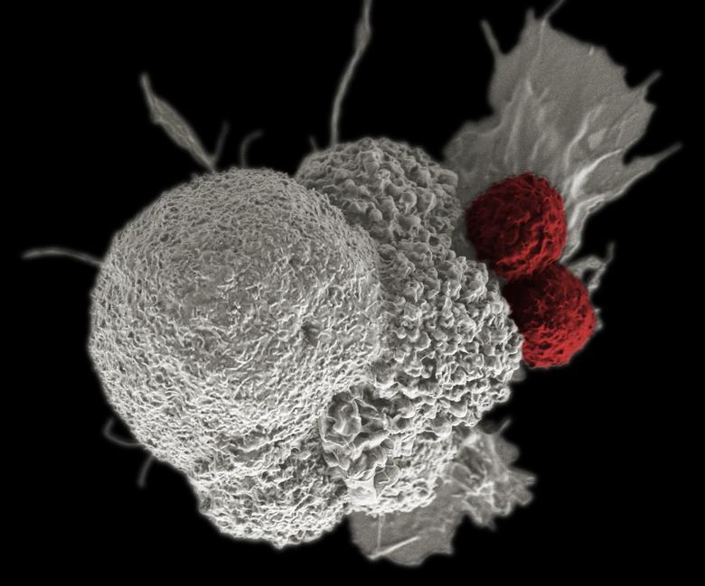 a cancer cell white being attacked by two cytotoxic t cells red photo reuters