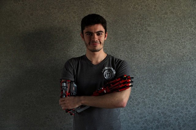 teenager builds himself a prosthetic arm using lego bricks