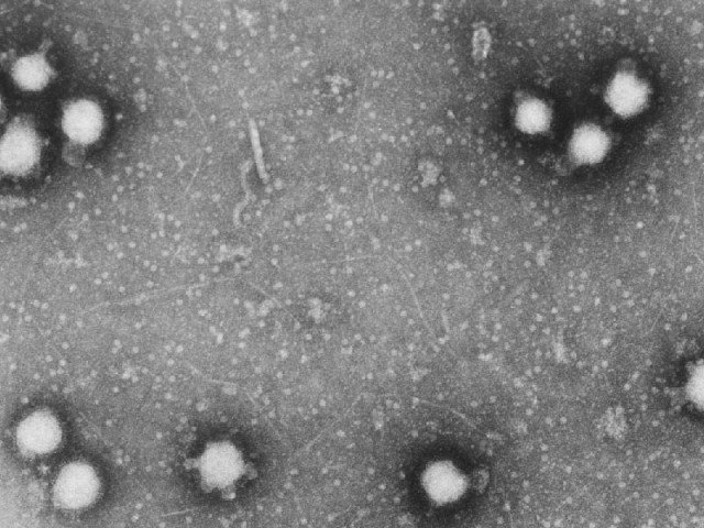 year s first congo fever case reported