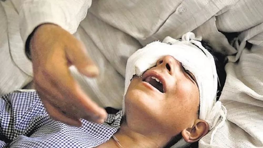 a father holds his son said to have been injured by indian security forces with pellet firing shotguns in occupied kashmir photo reuters file a father holds his son said to have been injured by indian security forces with pellet firing shotguns in occupied kashmir photo reuters file