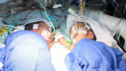 bangladesh mother has twins one month after first birth bangladesh mother has twins one month after first birth