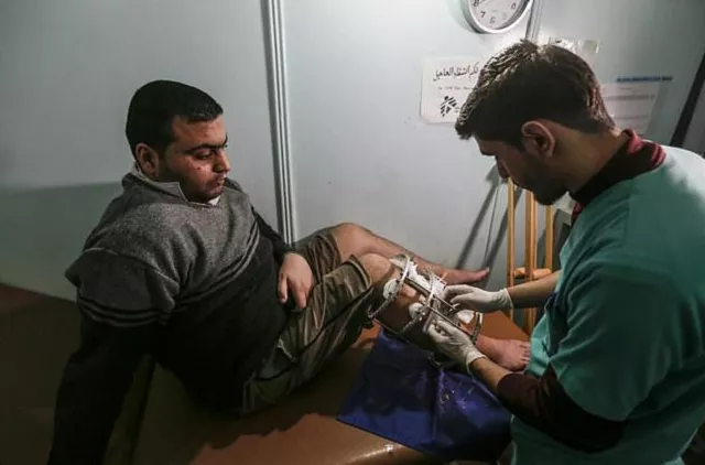 ezzedine al baz has had five operations on his leg since being shot a year ago photo afp ezzedine al baz has had five operations on his leg since being shot a year ago photo afp