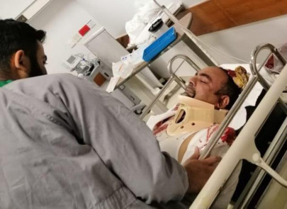 khwaja izharul hasan three others injured in road accident khwaja izharul hasan three others injured in road accident