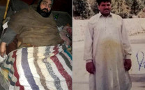 gujranwala man pleads with doctors to amputate his 150kg leg