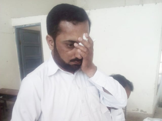 deputy superintendent muhammad ramzan was hit on face near his left eye almost turning him blind in one eye photo express deputy superintendent muhammad ramzan was hit on face near his left eye almost turning him blind in one eye photo express