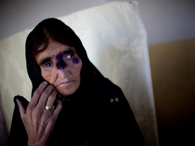 in k p leishmania reaches epidemic proportions in k p leishmania reaches epidemic proportions