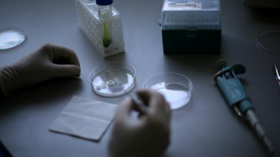 artificial skin a ray of hope for burn patients artificial skin a ray of hope for burn patients