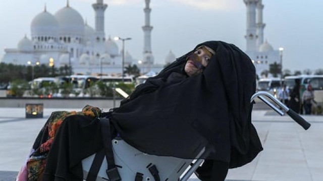 munira abdulla suffered severe brain injury after the car she was travelling in collided with bus in 1991 photo courtesy the national munira abdulla suffered severe brain injury after the car she was travelling in collided with bus in 1991 photo courtesy the national