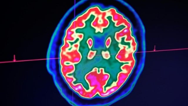 researchers at the university of california san francisco said they had successfully reconstructed quot synthetic quot speech using an implant to scan the brain signals of volunteers as they read several hundred sentences aloud photo afp researchers at the university of california san francisco said they had successfully reconstructed quot synthetic quot speech using an implant to scan the brain signals of volunteers as they read several hundred sentences aloud photo afp