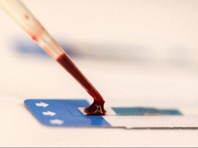 a nurse tests a blood sample photo reuters file a nurse tests a blood sample photo reuters file