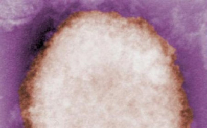 singapore reports first case of rare monkeypox virus singapore reports first case of rare monkeypox virus