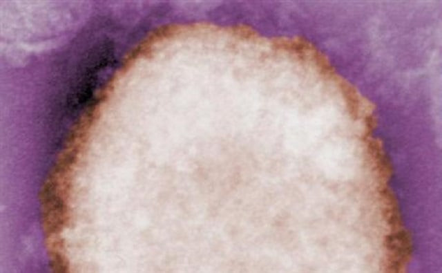 the monkeypox virus in an undated micrograph photo reuters reuters cdc the monkeypox virus in an undated micrograph photo reuters reuters cdc