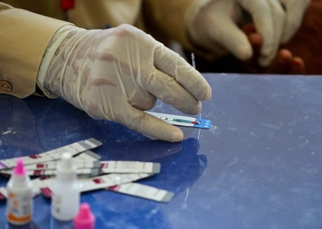 doctor examines the blood sample from a woman for a hiv test at a state run hospital in rato dero photo afp doctor examines the blood sample from a woman for a hiv test at a state run hospital in rato dero photo afp
