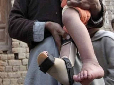 two more polio cases emerge in k p two more polio cases emerge in k p