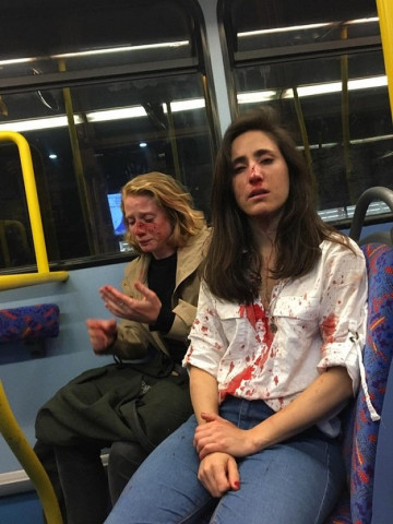 four men aged 15 to 18 have been arrested for the attack on melania geymonat and her partner chris photo facebook melania ps four men aged 15 to 18 have been arrested for the attack on melania geymonat and her partner chris photo facebook melania ps