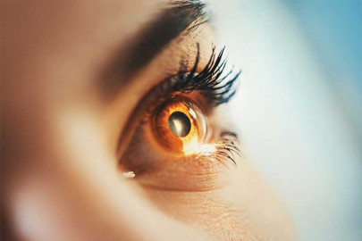 outbreak of red eye infection hits metropolis outbreak of red eye infection hits metropolis