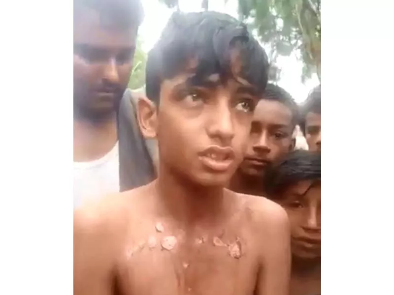 the view of the boy 039 s injuries from the alleged torture from his employer screengrab twitter naimatkhan the view of the boy 039 s injuries from the alleged torture from his employer screengrab twitter naimatkhan