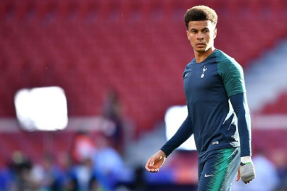 alli to miss start of premier league season with injury alli to miss start of premier league season with injury