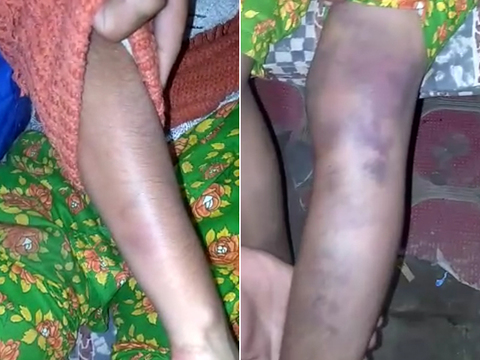 the victim shows the injuries when local police found her photos express